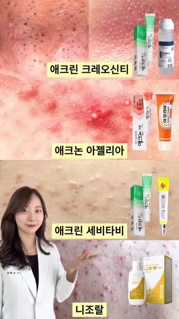 샤인약사 대표 릴스 1