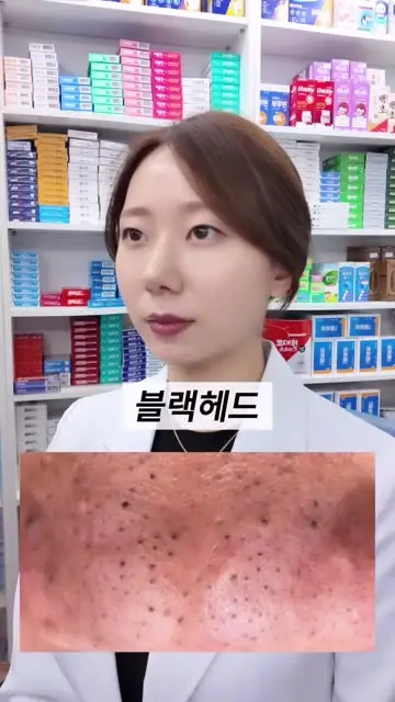 샤인약사 대표 릴스 2